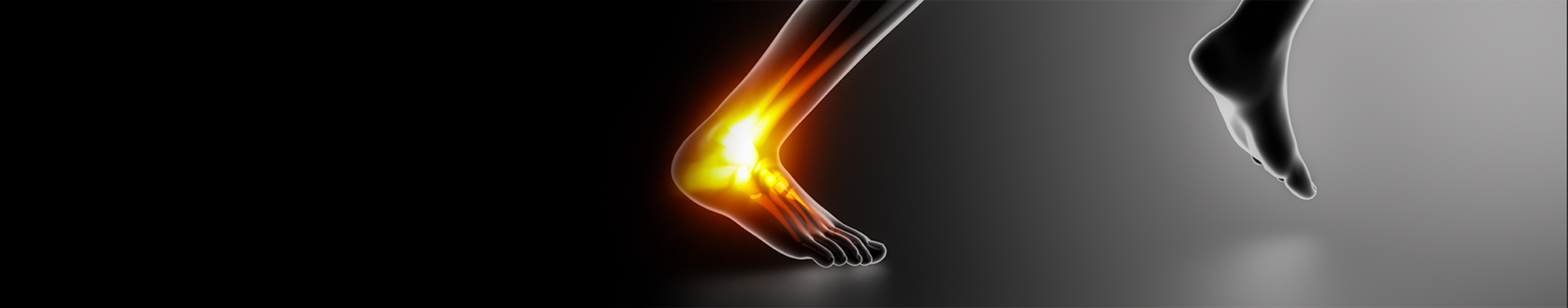 Achilles Tendinopathy